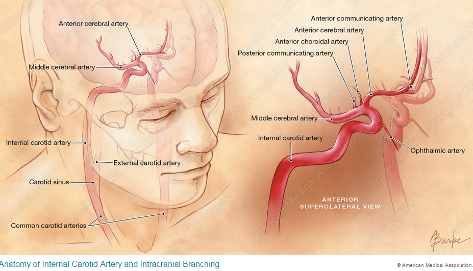 Internal Cateroid Artery