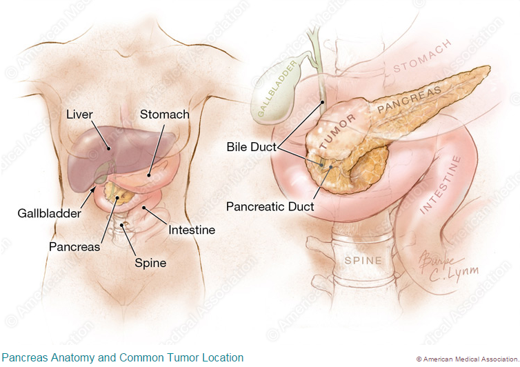 Pancreas Anatomy and Tumor Location