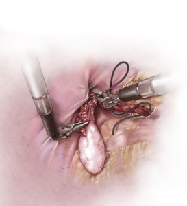 The Blood and Guts of medical Illustration