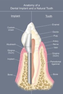 Tooth and Implant Anatomy Tina Pavlatos