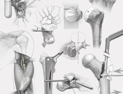 Specialty Feature: Orthopedics