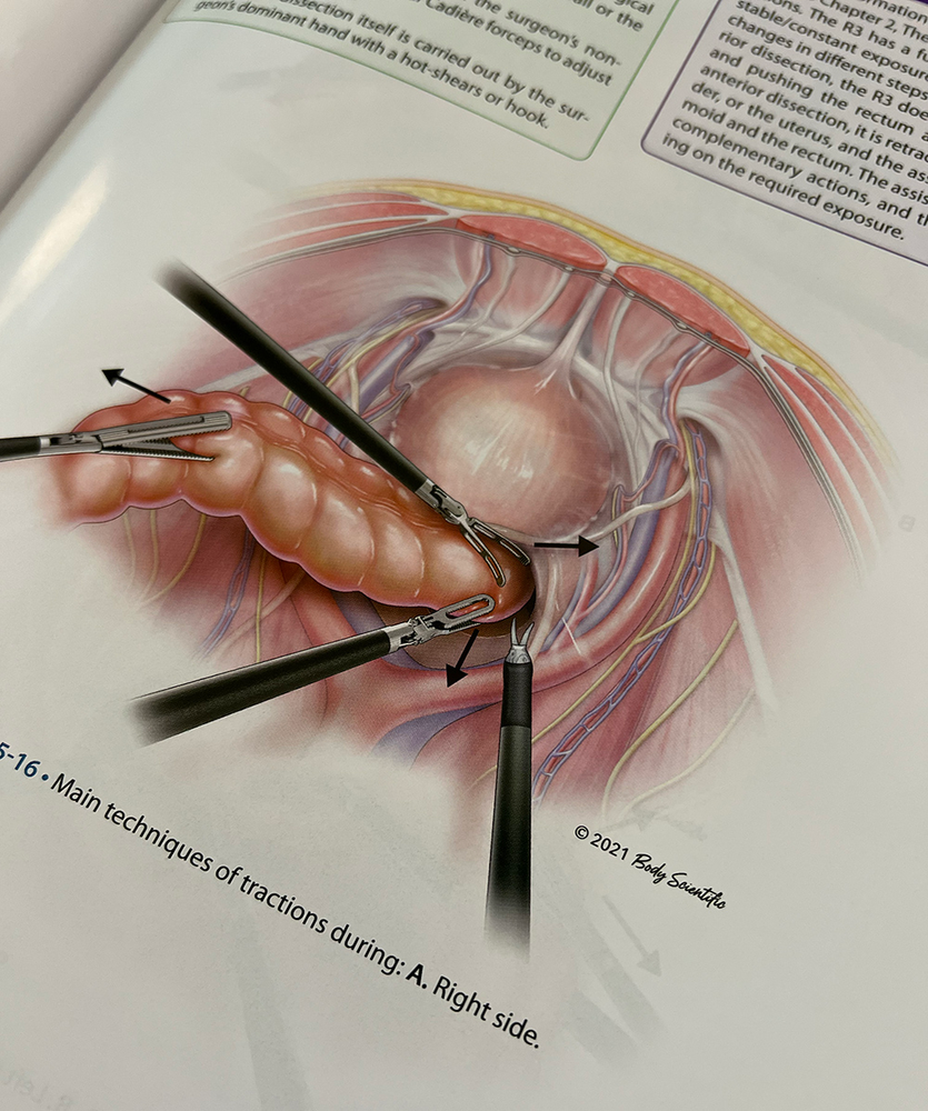 Medical Illustration with robotic tools