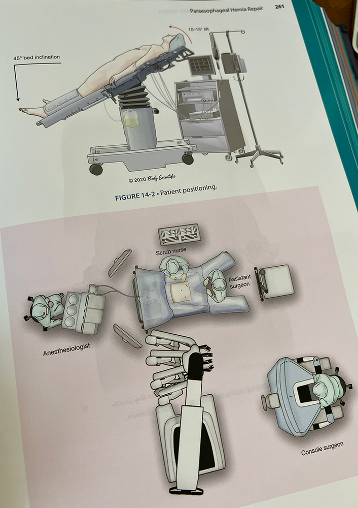 Illustration showing the setup of surgical equipment