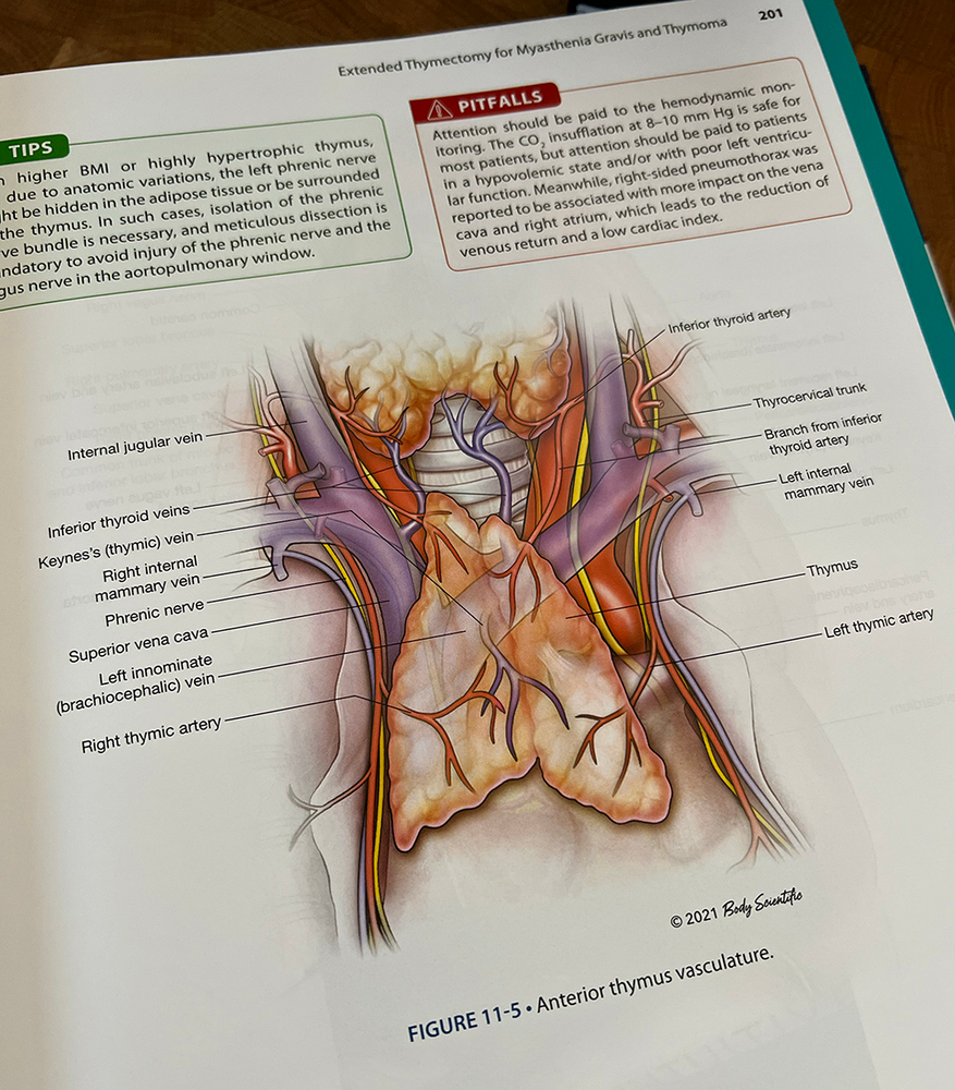 Illustration of the anterior thymus