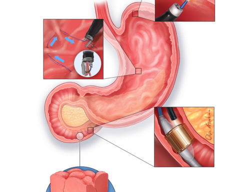 Visualizing Innovation in Obesity Treatment with Olga Kurkina
